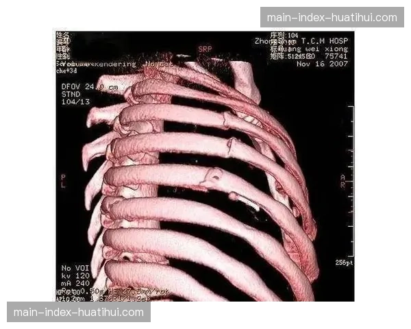 加拿大奥运希望之星训练中肋骨骨折,奥运前景蒙上阴影 加拿大奥运希望之星训练中肋骨骨折,奥运前景蒙上阴影